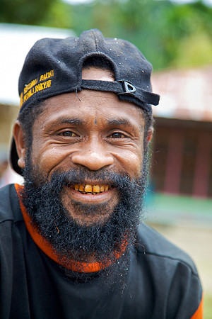 Betel Nut Smile